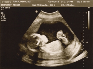 ultrasound 2014-12-10 13.jpg